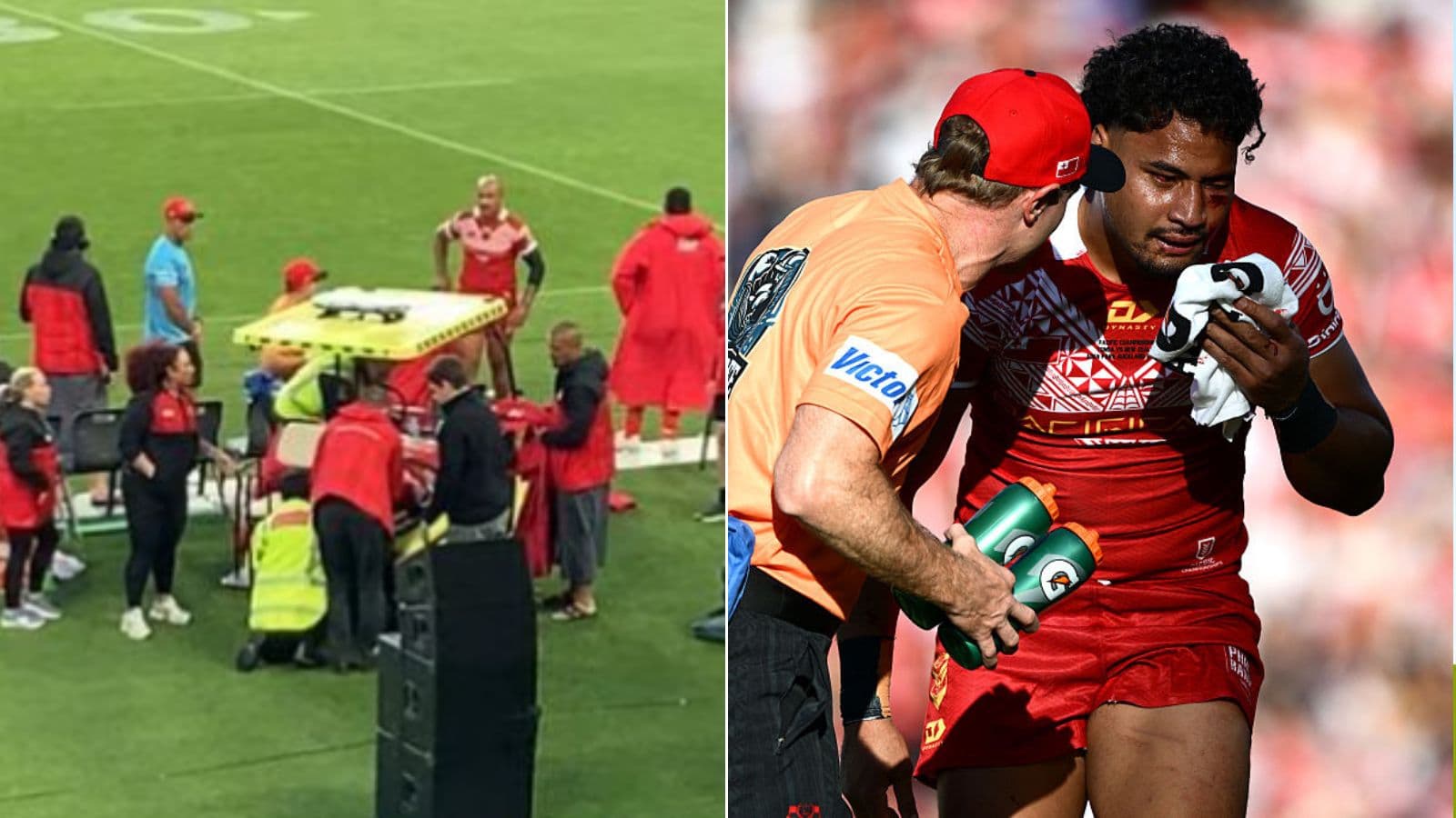 "It's heart-breaking": Storm give update on Katoa after brain surgery